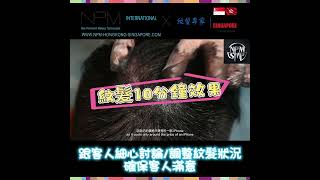 NPM紋髮專家—紋髮界的愛馬仕 共3間直營店 香港 新加坡 中國   #npm紋髮專家  #smp紋髮 #紋髮 #hairtransformation #hairtattoo #npm紋髮課程