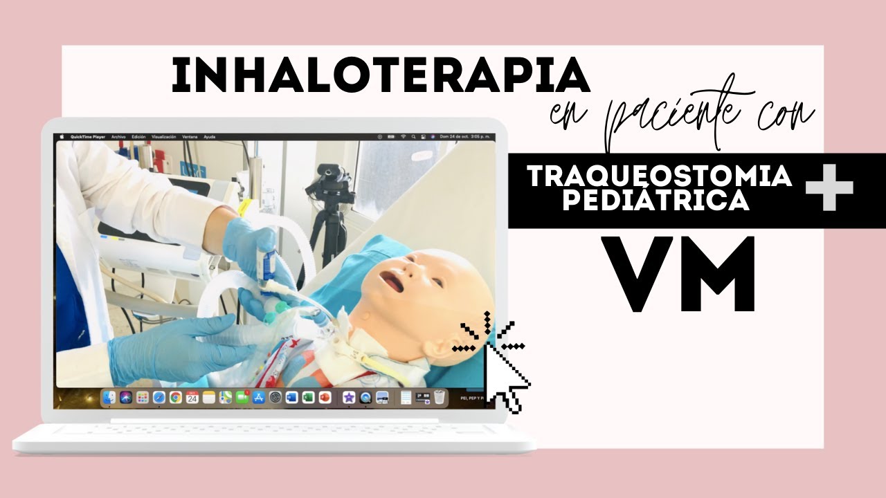 Inhaloterapia en Traqueostomia conectada a la Ventilación Mecánica VM