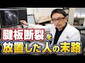 【腱板断裂】「手術しない」と「放置」の決定的な違いとは？悪化を防ぐ正しい治し方【けんばん断裂】