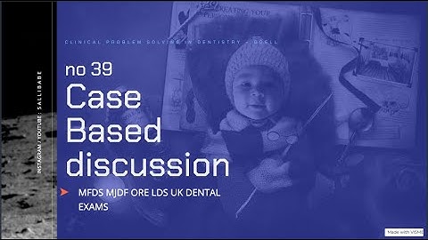 osce 39 for ORE / LDS / MFDS / MJFD exam part 2 osce spoken UK exam