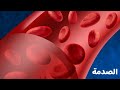 الصدمة المحاضرة 3 جراحة عامة سنة تانية ثانوي تمريض