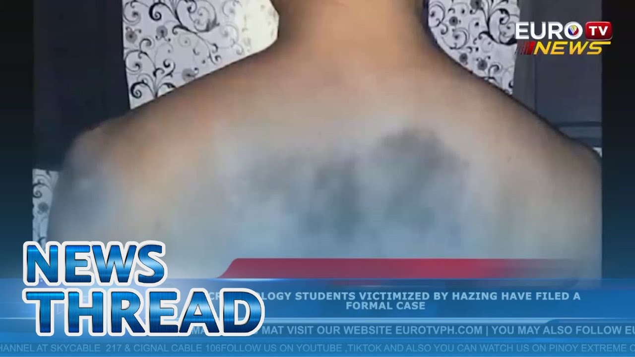 19 CRIMINOLOGY STUDENTS VICTIMIZED BY HAZING FILES FORMAL CASE | via Chelsea Victoriano, EuroTV News