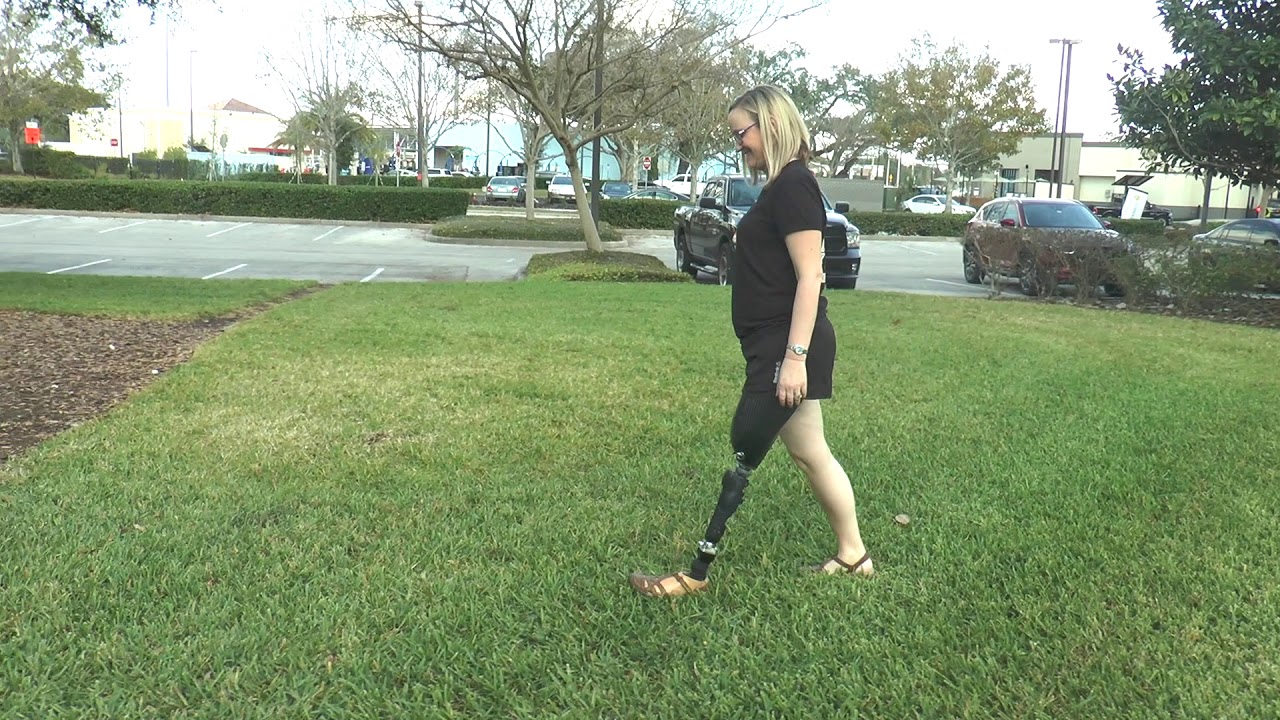 Kim, AK Amputee, on TaiLor Made Prosthetic Foot