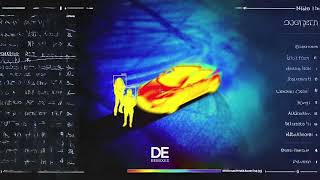 Icegerget,Sky Rae - Наследство Remix By Dermx