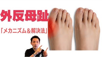 外反母趾 Youtube