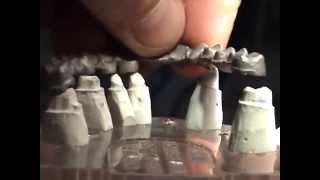 dental laboratory soldering by serogindentallab Ukraine
