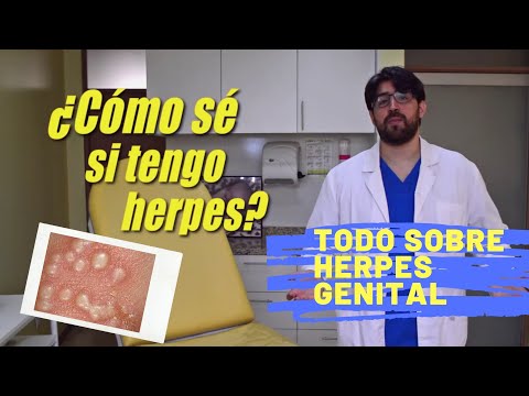 Herpes Genital ¿Tiene Cura? | Dr Ego