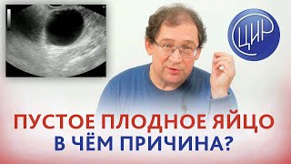 Пустое плодное яйцо. В чём причина пустого плодного яйца и что делать? Отвечает Гузов И.И.