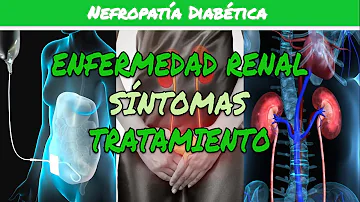 ¿Cuál es el síntoma más importante de enfermedad renal precoz por diabetes?