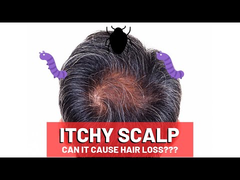 Itchy Scalp and Hair Loss (5 Big Causes!)