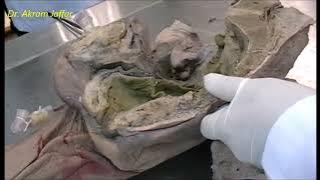Anatomy of female genital organs - dissection