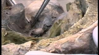 Anatomy of female genital organs - dissection