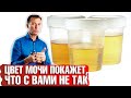 О чем говорит цвет мочи? Как узнать о проблемах со здоровьем 📣