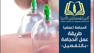 الحجامة_عملي [19] شرح تفصيلي خطوة بخطوة طريقة عمل الحجامة من الألف للياء حتى لا تنخدعوا screenshot 3