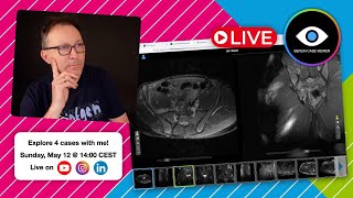 Explore 4 cases with me // Live-Stream on May 12 @ 14:00 CEST