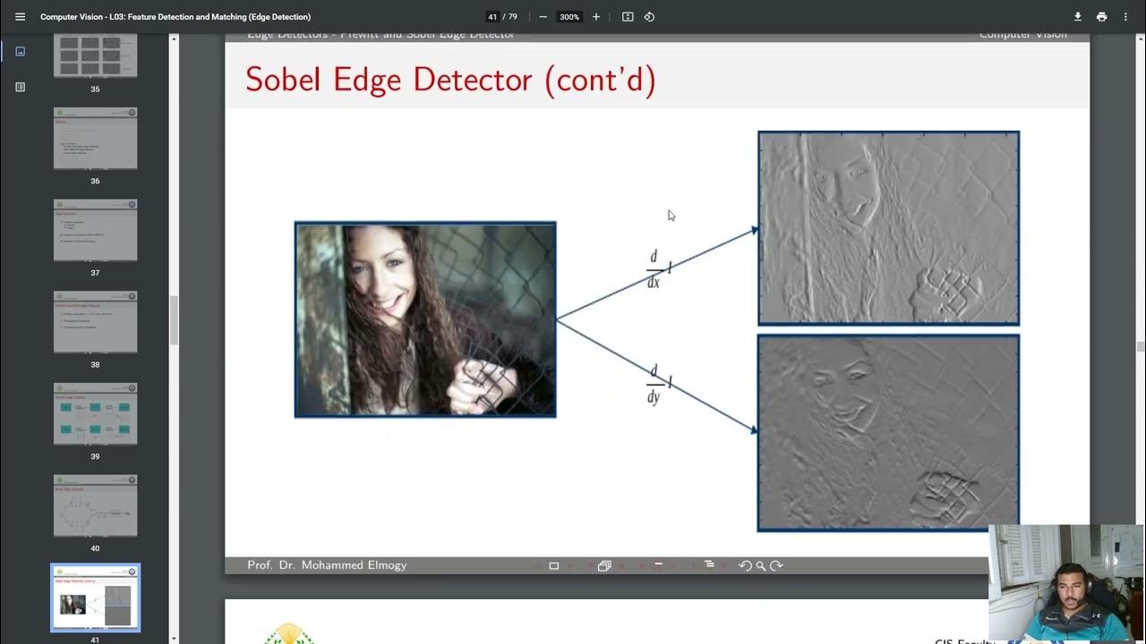 3- Lecture 3 - Feature Detection & Matching (Edge) - Medical ...