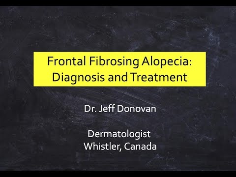 फ्रंटल फाइब्रोसिंग एलोपेसिया (एफएफए): निदान और उपचार