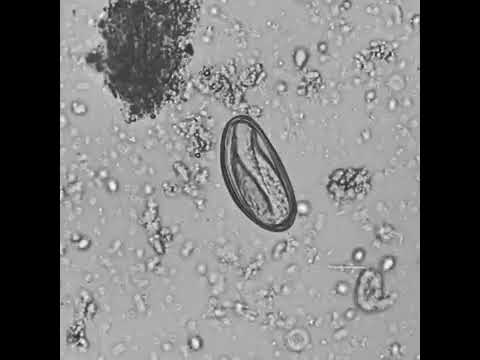 enterobius vermicularis ovo milyen férgek élnek