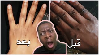 من الاستعمال الأول : تبييض اليدين + المفاصل | Bouishlife