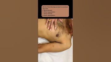 Clinical examination- CVS #cvs  #healthcareprofessionals #doctors