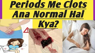 Periods मे Blood Clots ज्यादा आने का क्या मतलब होता है|| अगर आपको भी आते ये Clots तो हो जाए सावधान |