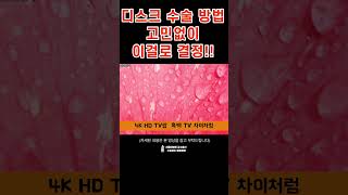 허리협착증 허리디스크 수술 고민인데, PSLD 모르신다면? #척추내시경수술 #PSLD수술 #허리수술잘하는병원