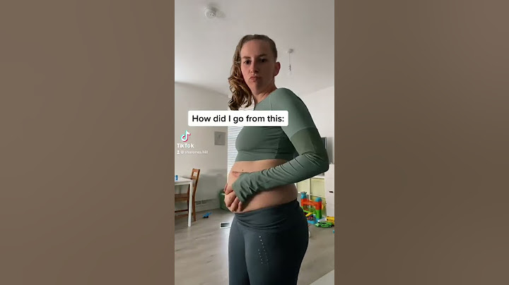 Extreme Weightloss Transformation!!😱 #fatloss #weightloss
