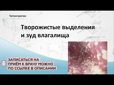 Творожистые выделения и зуд влагалища