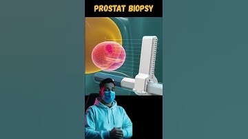 Transperineal Prostate Biopsy Procedure 3D animation #ProstateBiopsy, #ProstateHealth