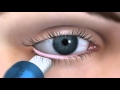TearScience - Neue Verfahren bei Trockenem Auge