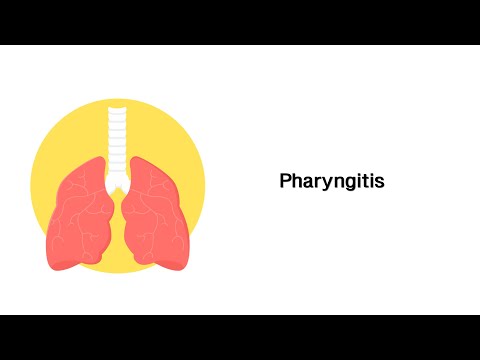 Halsentzündung (Pharyngitis - Rachenentzündung) - Erkrankungen der Atemwege