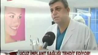 Implant Markası Önemli Mi