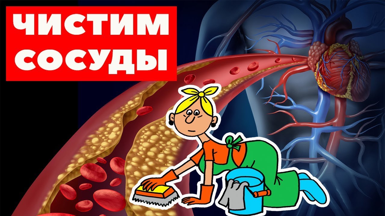 Чистка СОСУДОВ от холестерина / Чем очистить СОСУДЫ / Продукты для ...