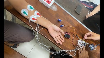 Điều khiển động cơ Servo bằng Arduino và cảm biến cơ bắp EMG   |   Trần Duy Khương - 2011456