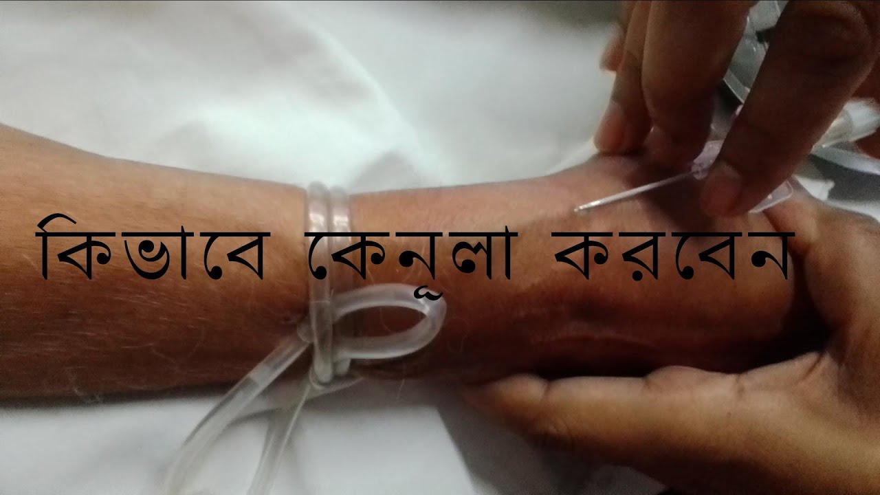 How to Cannulaization - YouTube