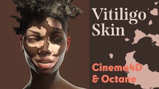 Cinema 4D Quick Tip - Vitiligo Skin w. Octane