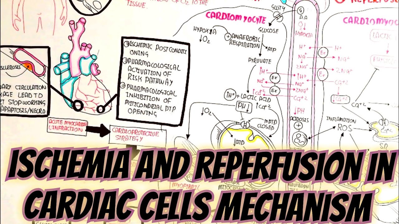 Ischemia And Reperfusion Mechanism In Cardiomyocytes ...