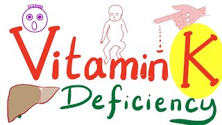 Vitamin K Deficiency | Hemorrhagic Disease of the Newborn