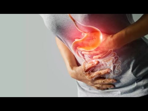 Video: Gastrit, Diafragma Churra - Xalq Retseptlari