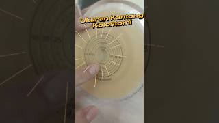 Colostomy Bag Installation Tricks #youtubeshorts #shorts
