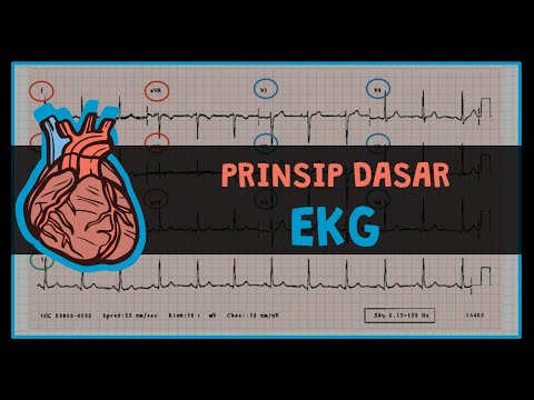 Dasar-Dasar EKG  (Prinsip EKG) : #1 ELEKTROKARDIOGRAM