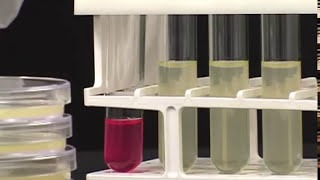 Sistema automático de amostragem/dosagem EasySpiral Dilute - Interscience