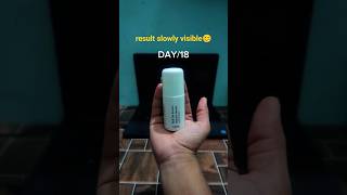 18 Days Using cosIQ Serum | Real Review Net Worth