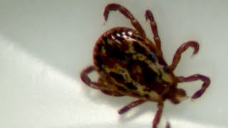 Experts weigh in on how to stay safe from ticks