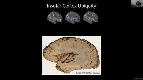 Brain Dynamics and Flexible Behaviors - Lucina Uddin