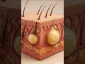 After Shave Ingrown Hair - Folliculitis