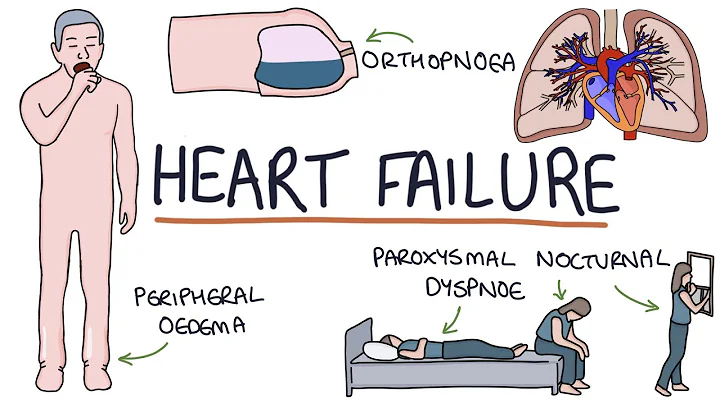 Understanding Heart Failure: Visual Explanation for Students - DayDayNews