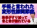 手術と言われた変形性膝関節症①