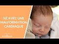 N avec une malformation cardiaque  la maison des maternelles lmdm