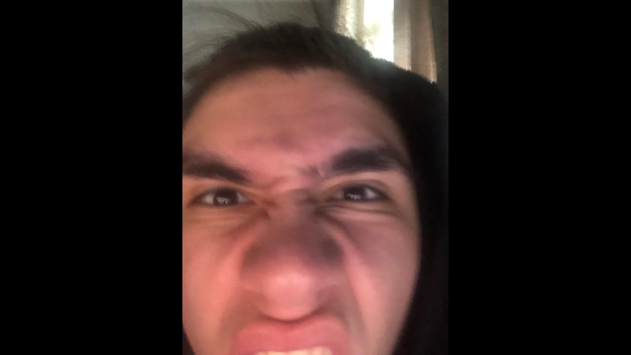 ЧУТЬ НЕ ОТКИНУЛСЯ ИРЛ СЛЕПЫМ, ну как чуть, не чуть , ну как откинулся ...